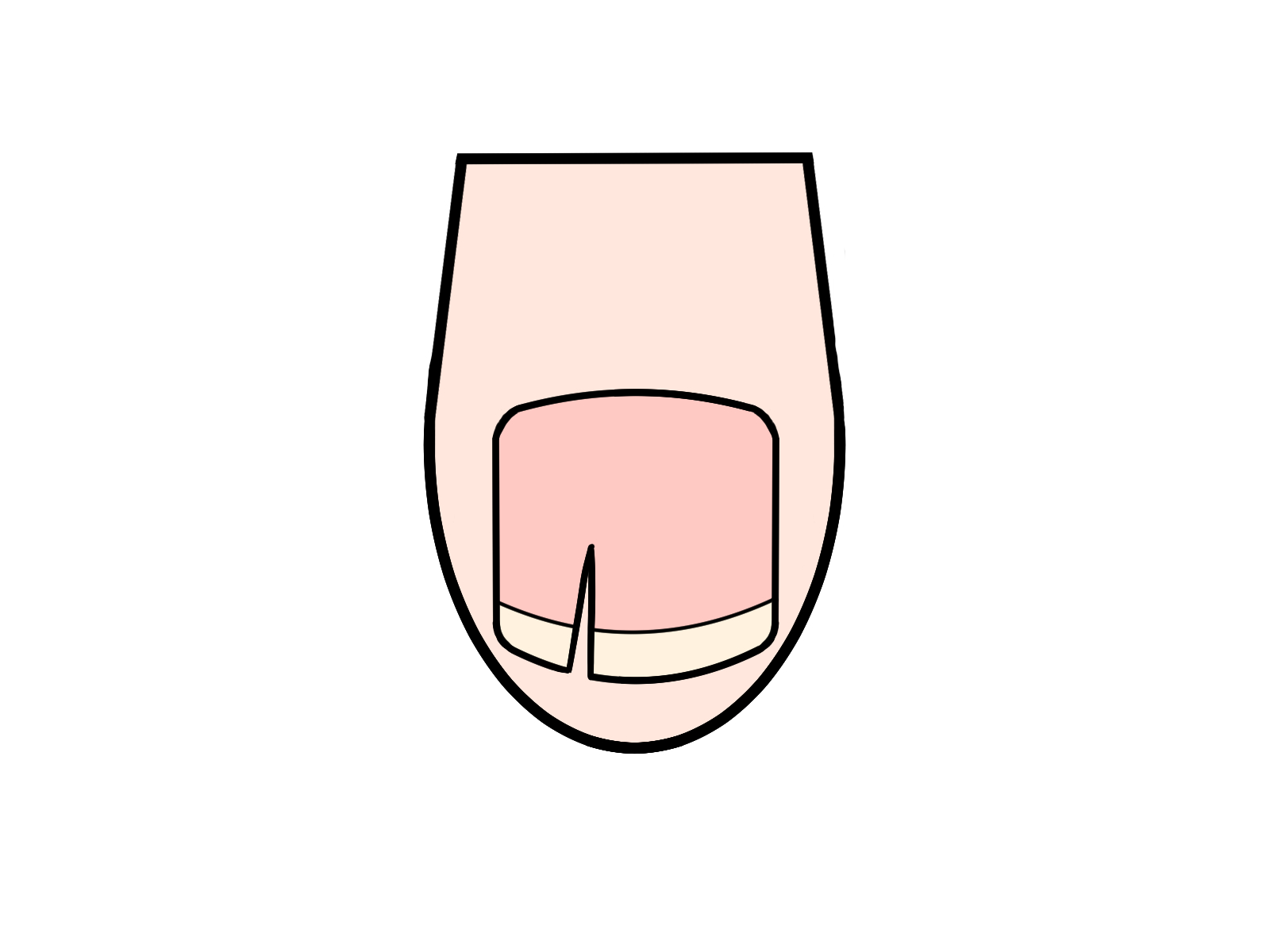 透明プレートで補正するイメージ